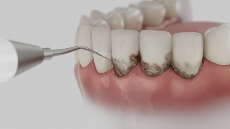 Reliable Tooth Extraction contractor in Countryside, VA by Smile Center Dentistry